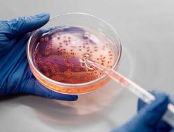 Disease detective tracks an invisible virus